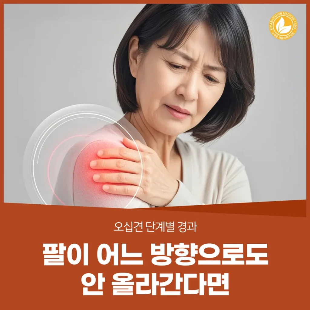 팔이 어느 방향으로도 안 올라간다면 — 오십견 단계별 경과
