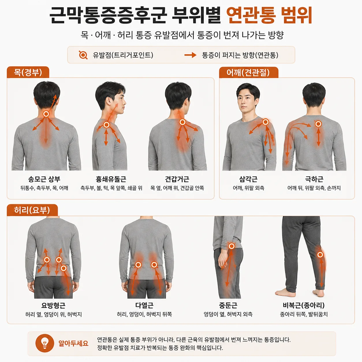 근막통증증후군 부위별 연관통 범위