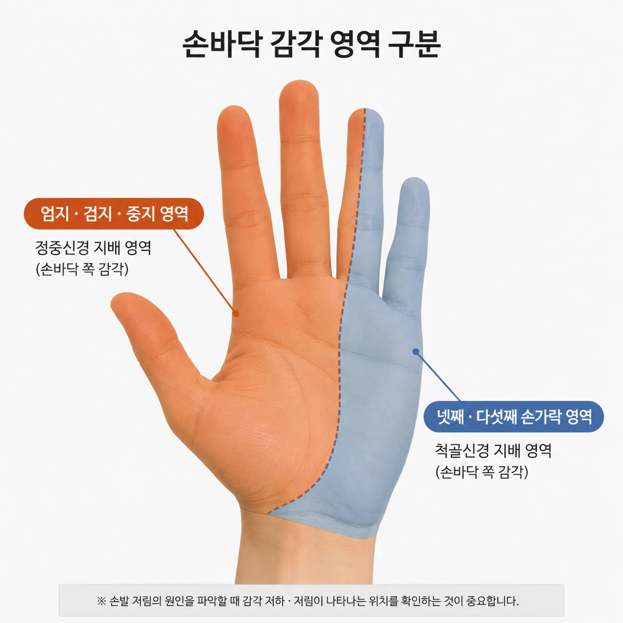 저린 손가락 조합에 따라 손목과 팔꿈치로 나뉘는 신경 분포 도해