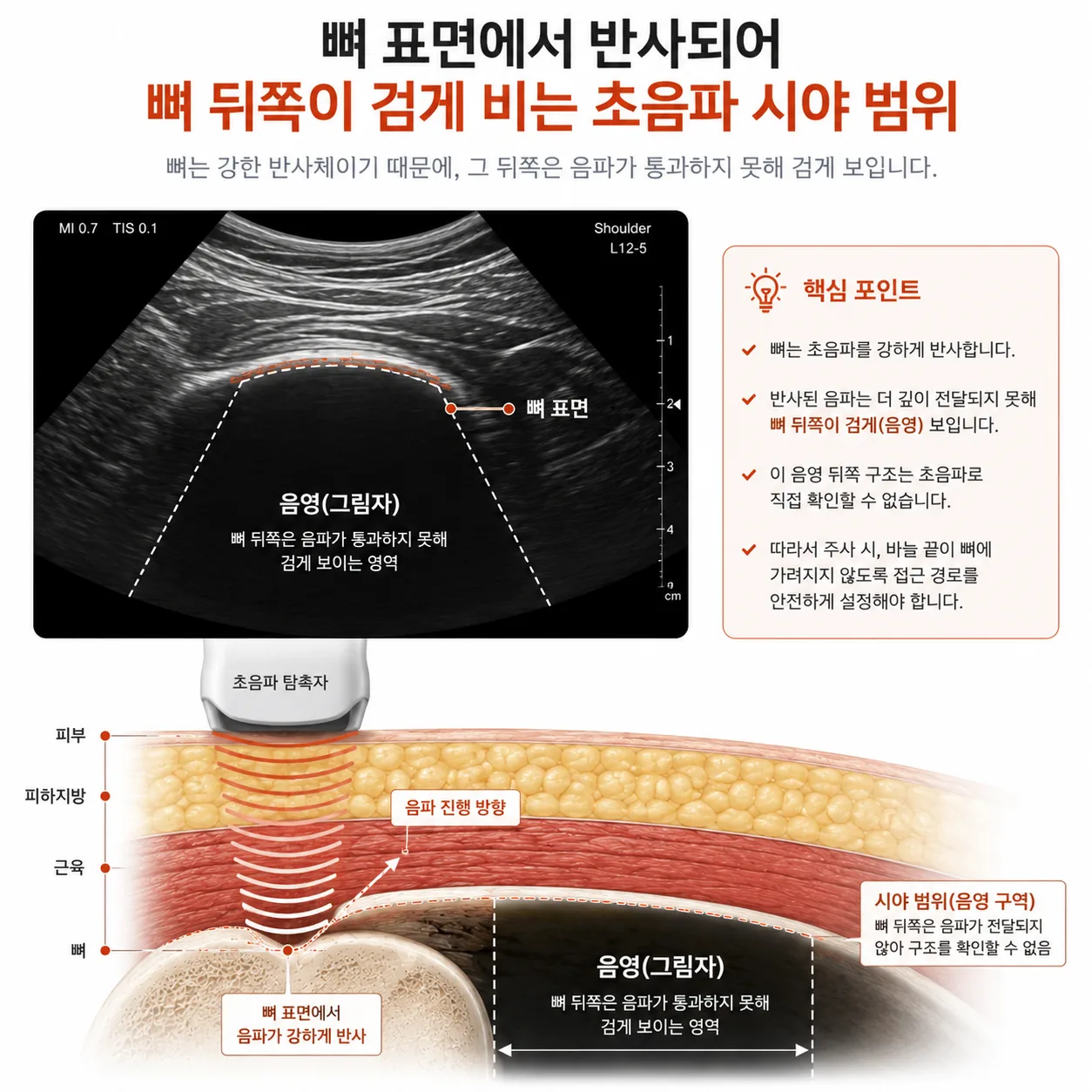 초음파 시야 범위 도식