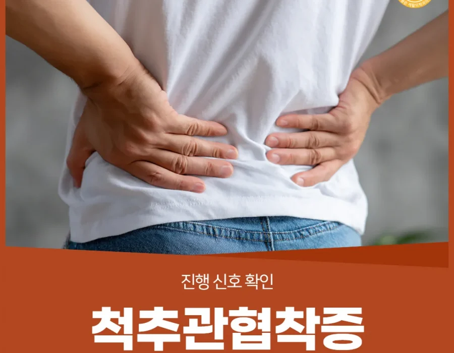 척추관협착증, 걸으면 저리고 쉬면 괜찮다면 — 진행 신호 확인