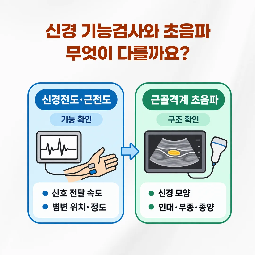 신경 기능 측정 파형과 초음파 단면 화면을 나란히 비교한 검사 대조 개념도