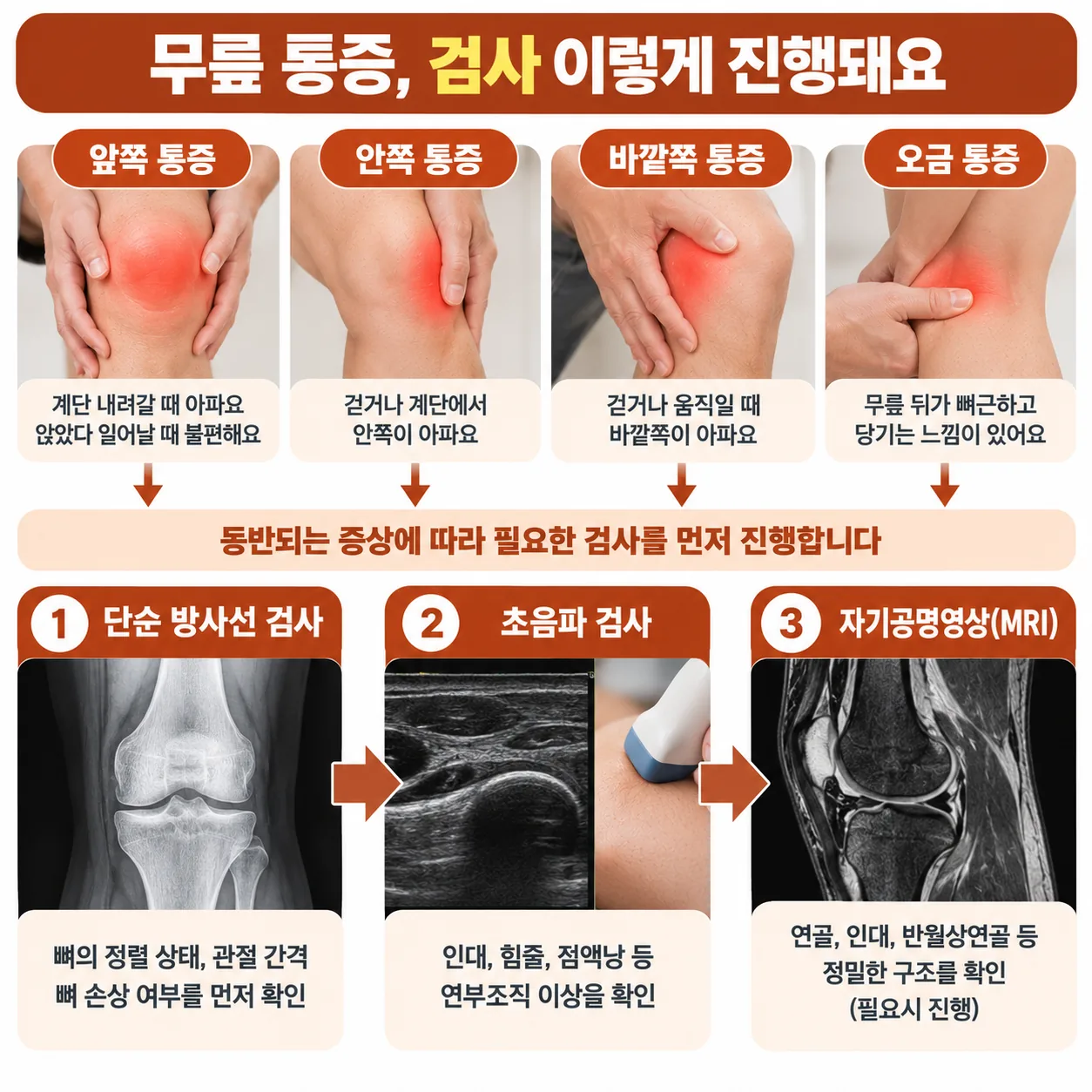 무릎 통증 자리와 동반 신호에 따라 단순 방사선 초음파 자기공명영상이 배정되는 순서를 보여 주는 흐름도